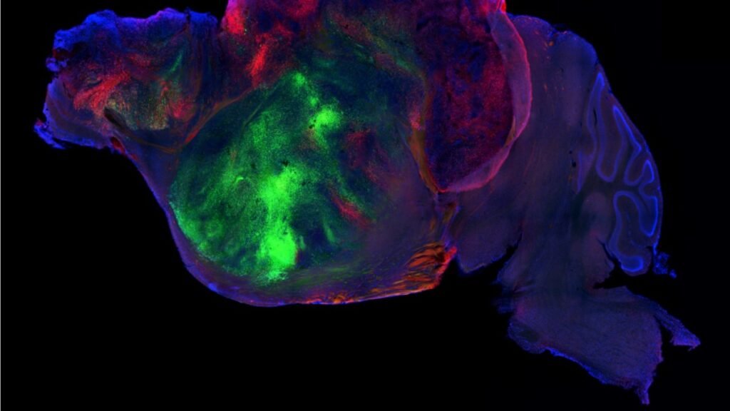 Du tissu cérébral humain greffé dans le cerveau de souris : une percée scientifique inédite