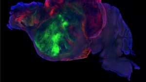 Du tissu cérébral humain greffé dans le cerveau de souris : une percée scientifique inédite