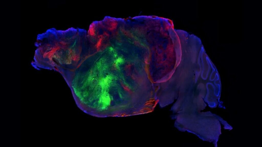 Tissu cérébral humain greffé dans le cerveau de souris : une avancée médicale inédite