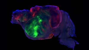 Tissu cérébral humain greffé dans le cerveau de souris : une avancée médicale inédite