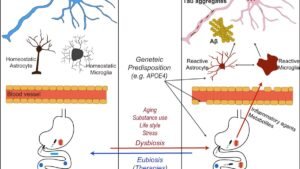 Alzheimer : le microbiote intestinal peut-il ralentir la maladie ?